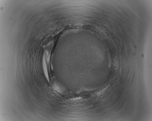 X0000085260818200703231713