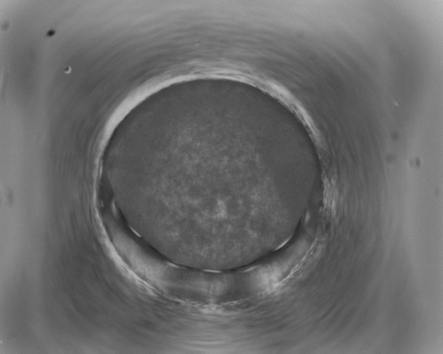 X0000085261520200703231702