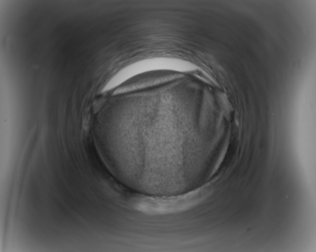 X0000085260033200703301842