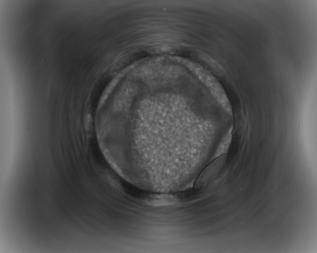 X0000085260087200703301842