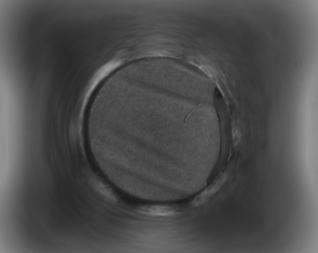 X0000085260104200703301841