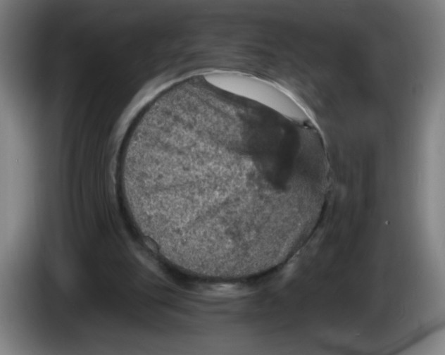 X0000085260151200703301840