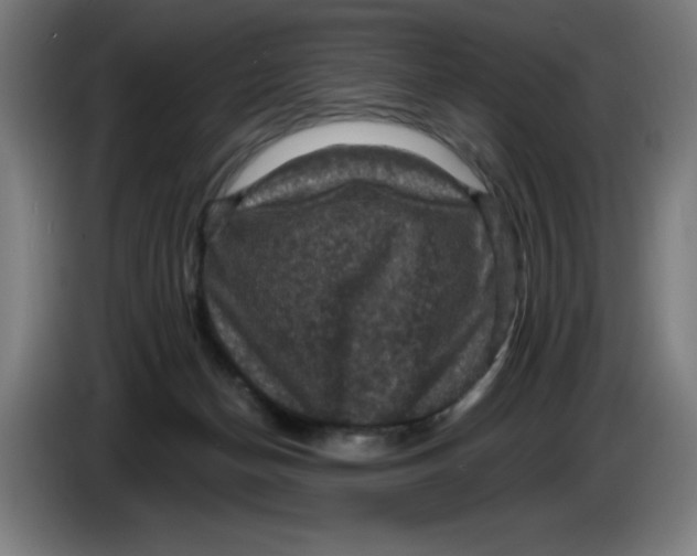 X0000085260174200703301840