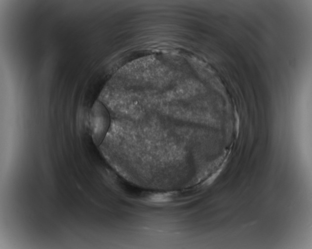 X0000085260178200703301840