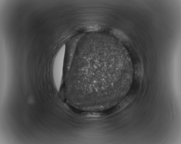 X0000085260369200703301838