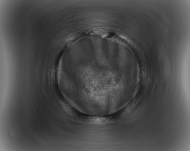 X0000085260379200703301838