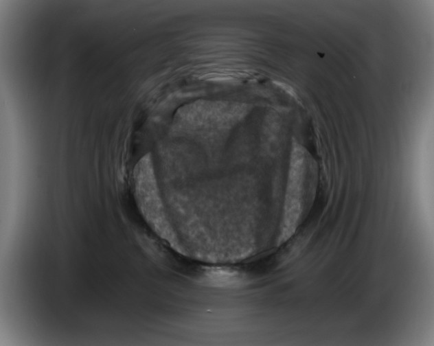 X0000085260380200703301838