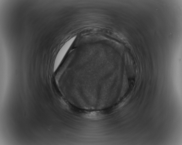 X0000085260382200703301838