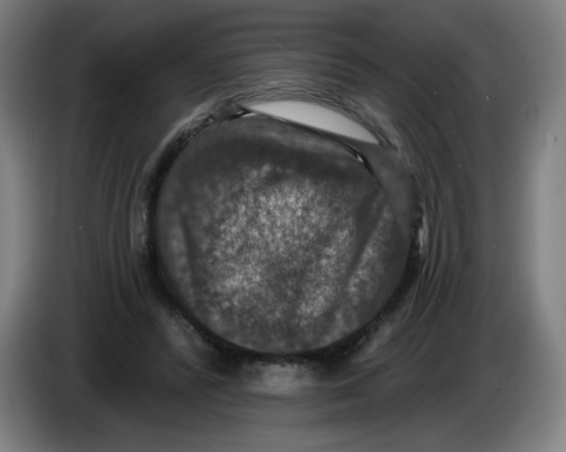 X0000085260400200703301837