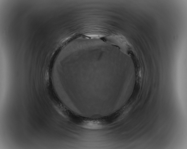 X0000085260500200703301835