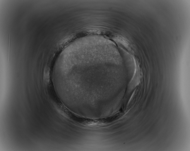 X0000085260504200703301835