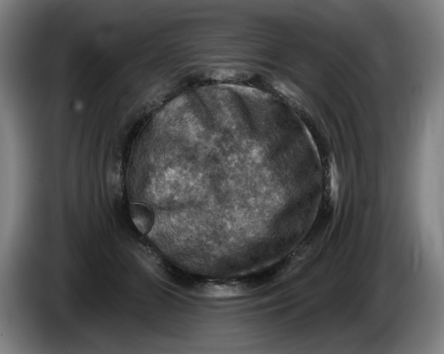 X0000085260510200703301835