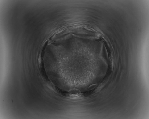 X0000085260516200703301835