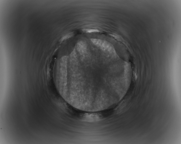 X0000085260520200703301835