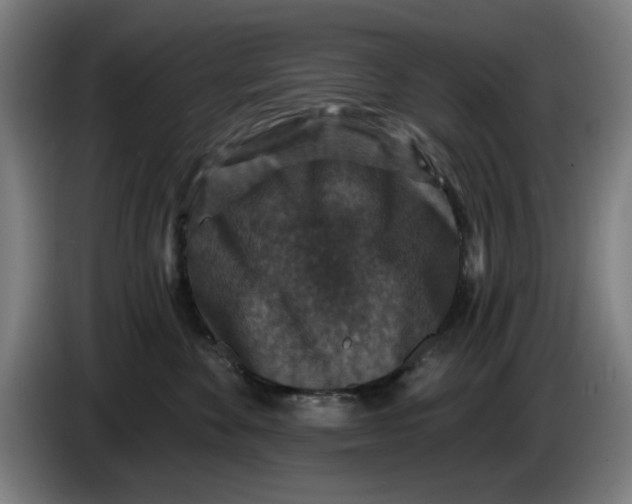 X0000085260524200703301835