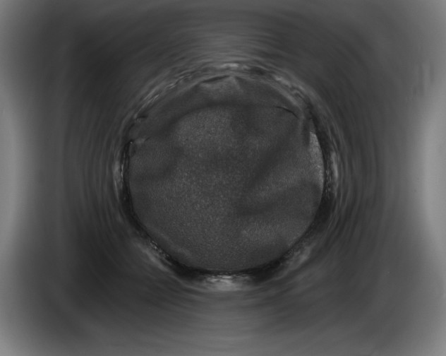 X0000085260558200703301835