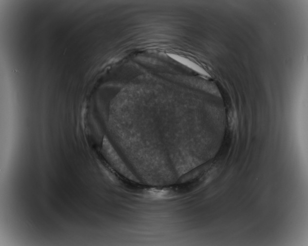 X0000085260570200703301835