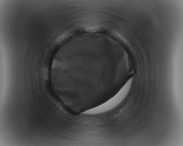 X0000085260689200703301833