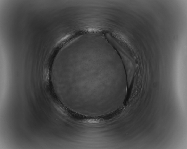 X0000085260692200703301833