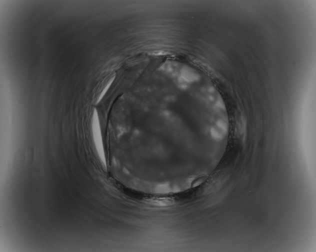 X0000085260711200703301832