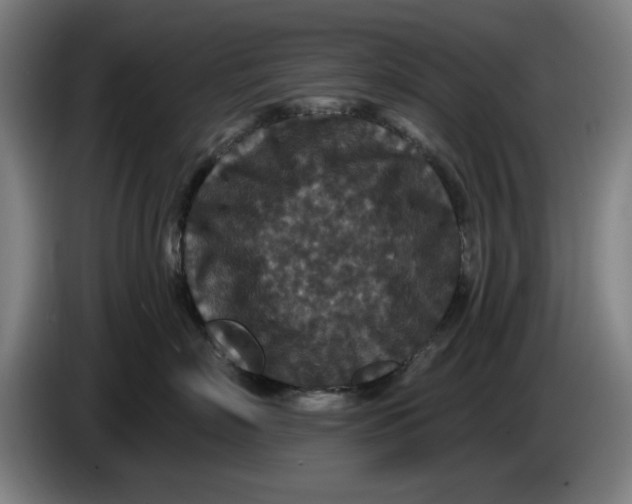 X0000085260718200703301832