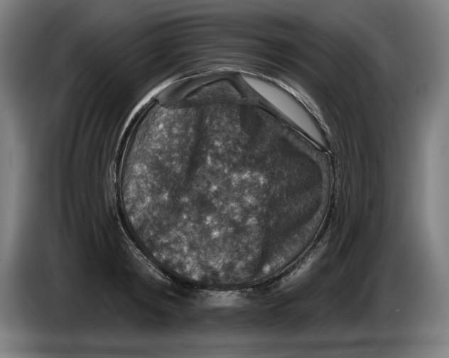 X0000085260798200703301831