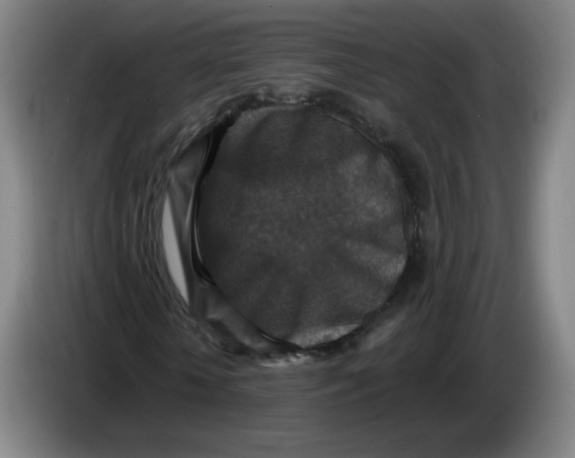 X0000085260818200703301830