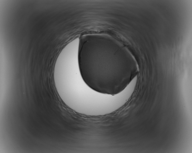 X0000085261010200703301828