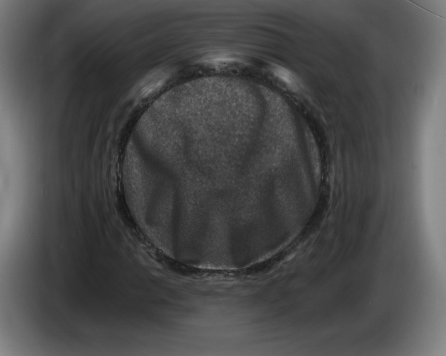 X0000085261014200703301828