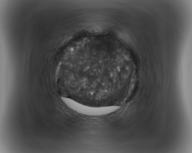 X0000085261297200703301824