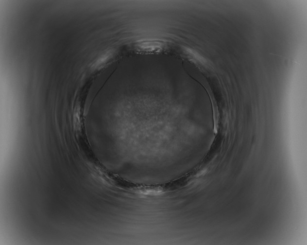 X0000085261394200703301822