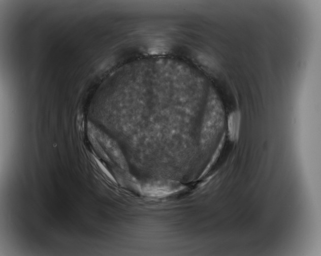 X0000085261443200703301822