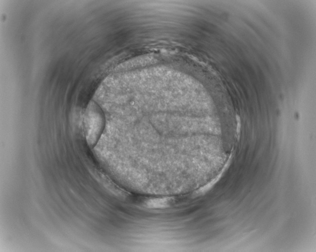 X0000085260178200704092124