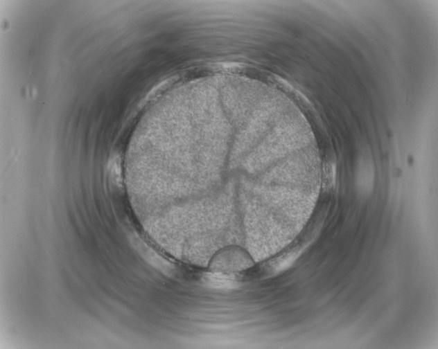 X0000085260238200704092122