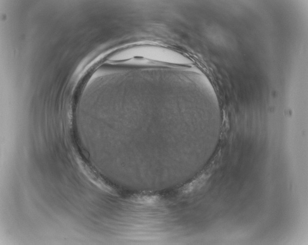 X0000085260247200704092122