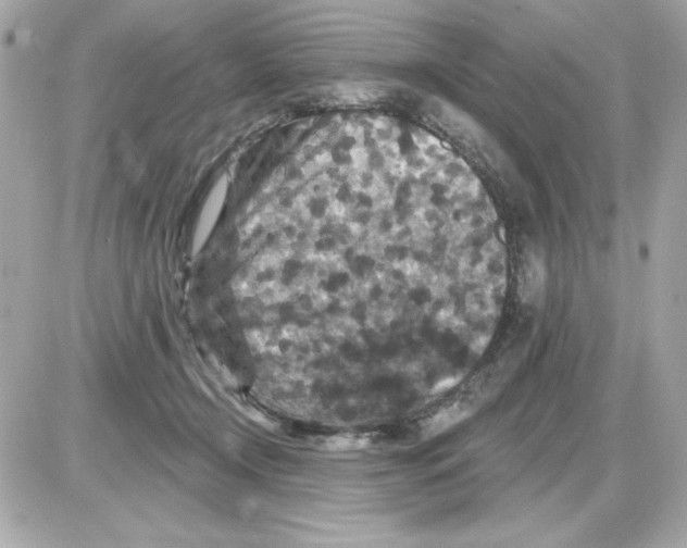 X0000085260366200704092120