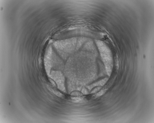 X0000085260516200704092118