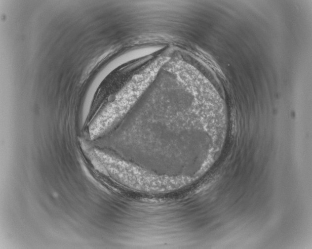 X0000085260538200704092117