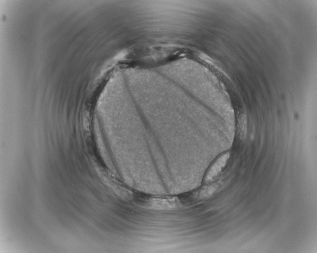 X0000085260571200704092117