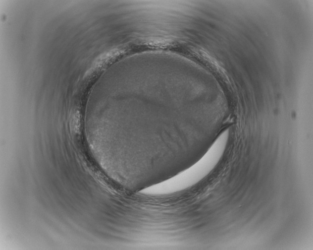 X0000085260689200704092115