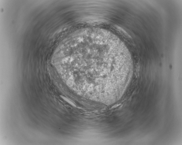 X0000085260917200704092110