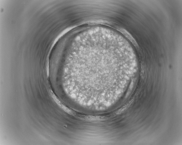 X0000085261036200704092109