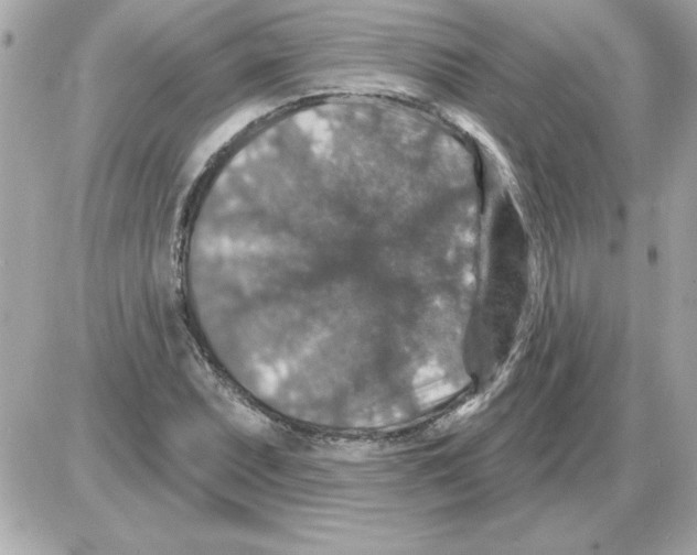 X0000085261071200704092108