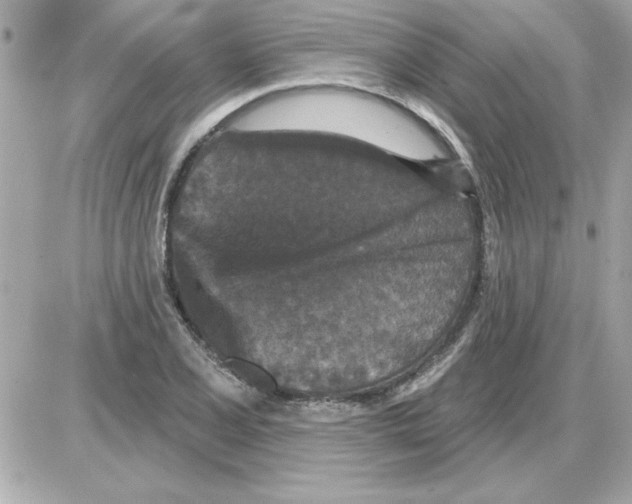 X0000085261077200704092108