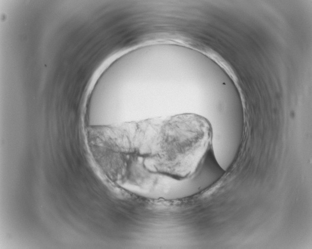 X0000085261104200704092108