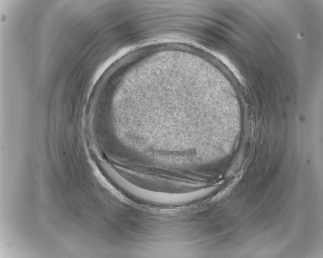 X0000085261134200704092107