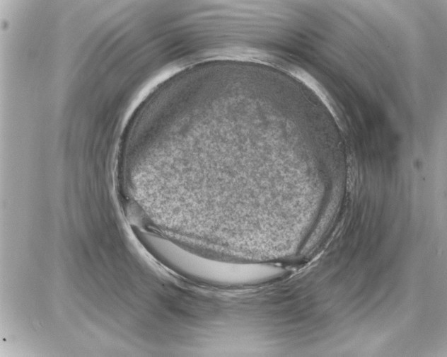 X0000085261139200704092108