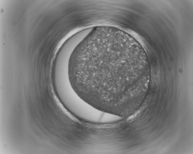 X0000085261142200704092108