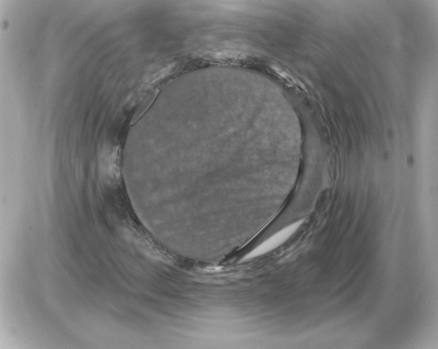 X0000085261156200704092107