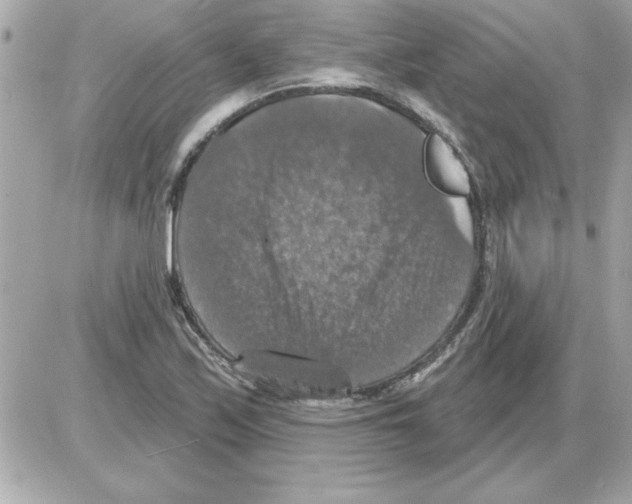 X0000085261171200704092107